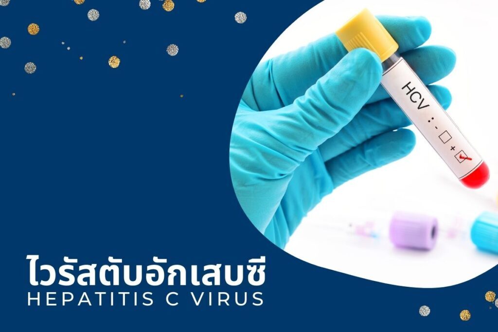 Hepatitis C Virus