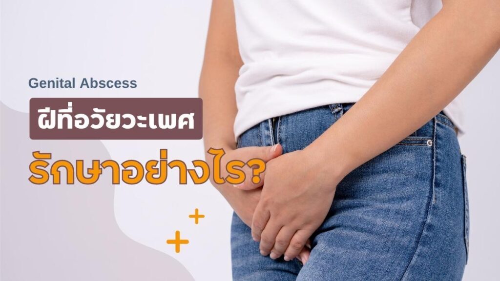 ฝีที่อวัยวะเพศ รักษาอย่างไร