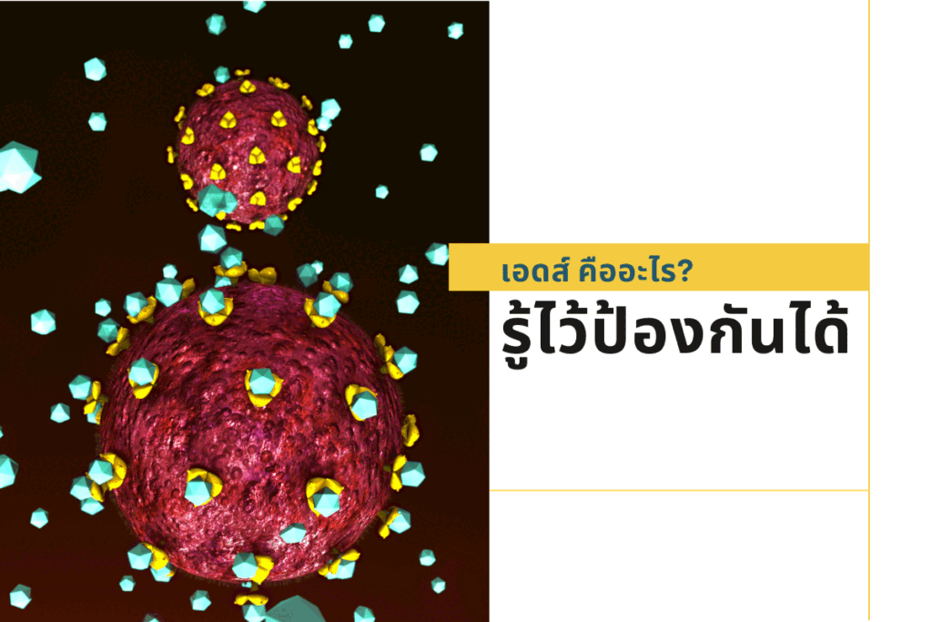 เอดส์