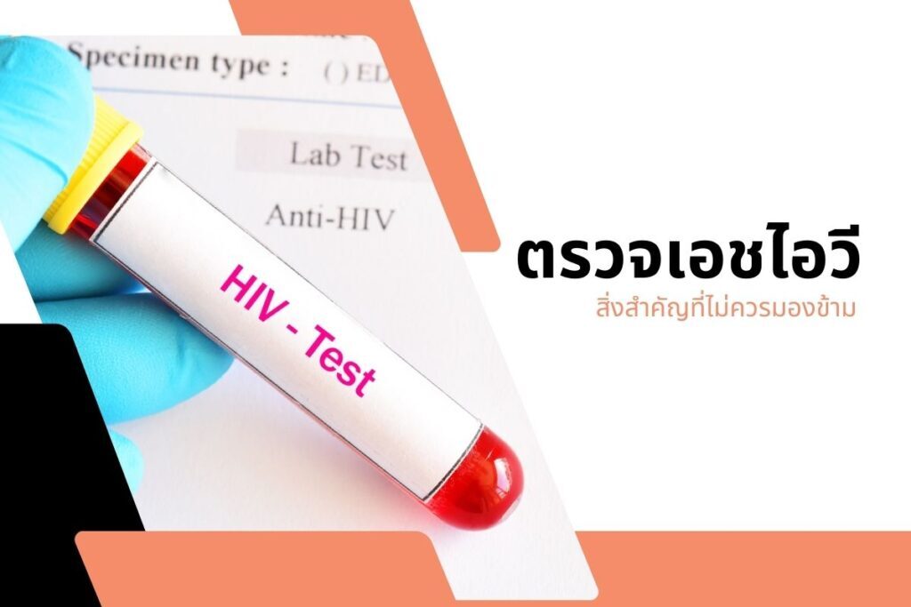 ตรวจเอชไอวี